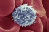 מדענים מצאו דרך, גורמים לתאי T להתחיל להילחם בסרטן