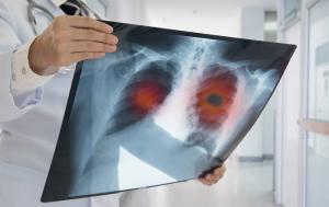 צילומי רנטגן: מה המינון עבור בני אדם הוא מסוכן?