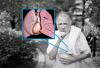 קריש דם בעורק הריאה: אל תחמיצו את הסימנים הראשונים