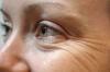 כיצד למנוע את הופעתם של קמטים סביב העיניים