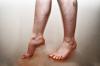 פרה של זרימת דם ברגליים: גורמים, סימפטומים
