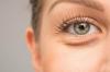 שקיות מתחת לעיניים: קוסמטיקאיות לייעץ כיצד להיפטר