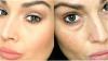 5 מתכונים עתיקים כדי לסייע להפוך את רעננה המראה העור אלסטי סביב העיניים ואת הצעירים